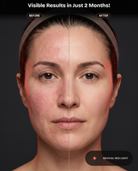 Revival Aura visible results in just 2 months, front-facing before and after skin comparison
